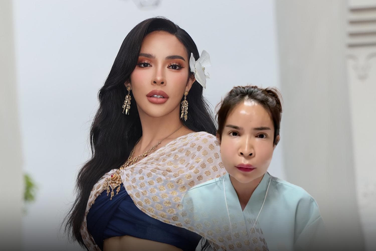 ก่อนฉีดหน้า ต้องดูให้ดี : บทเรียนเจ็บปวดจาก 'นัท นิสามณี' ถึงอันตราย 'หมอกระเป๋า'